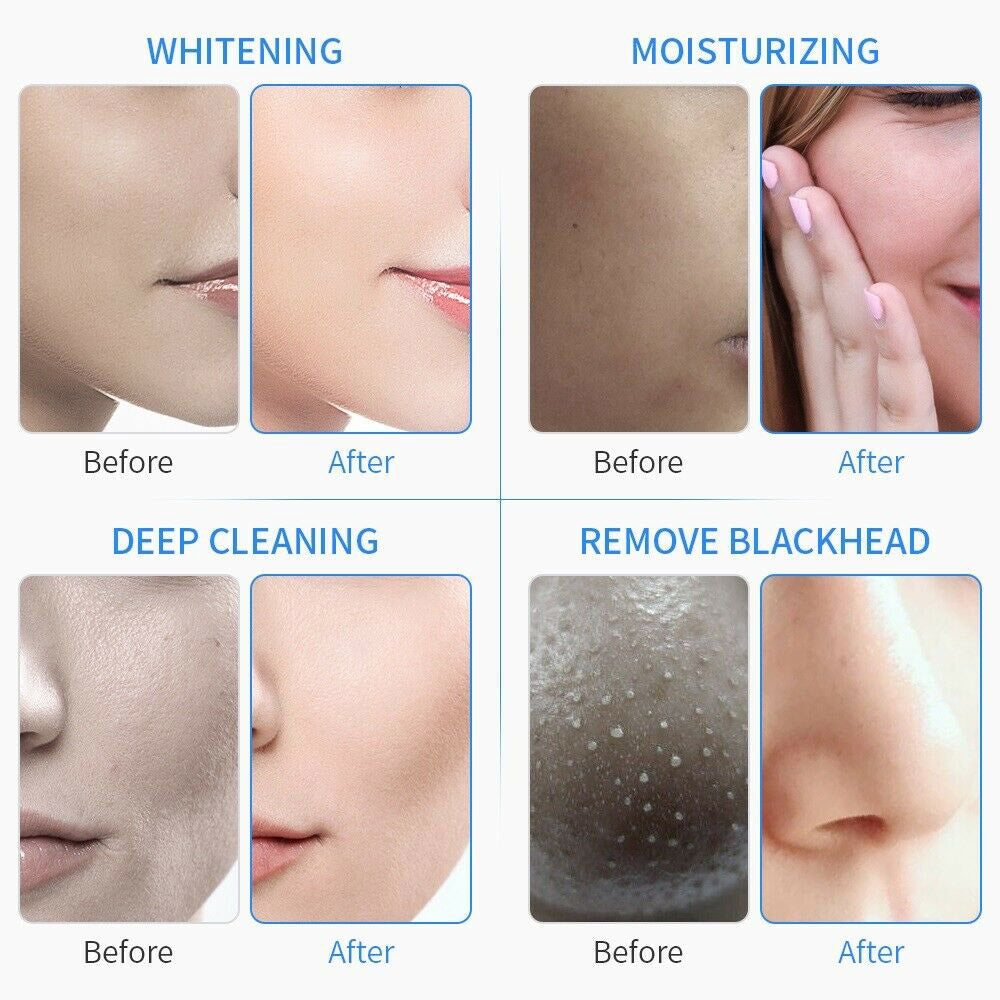 6 in 1 Hydrogen Oxygen Small Bubble Hydro Dermabrasion Machine